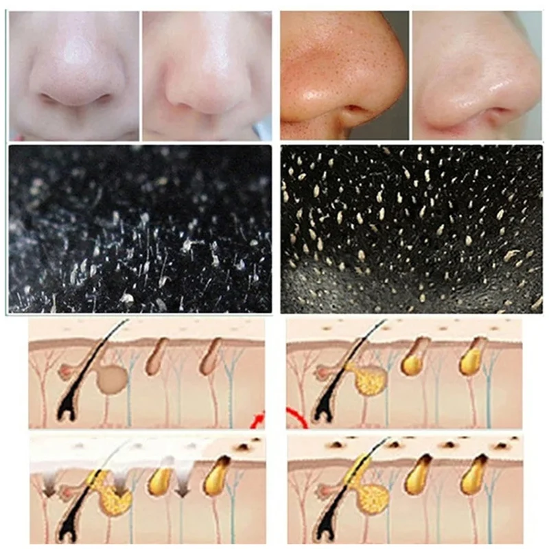 10pcs Blackhead Nose Strips De - đánh giá và giá Cleanser Face