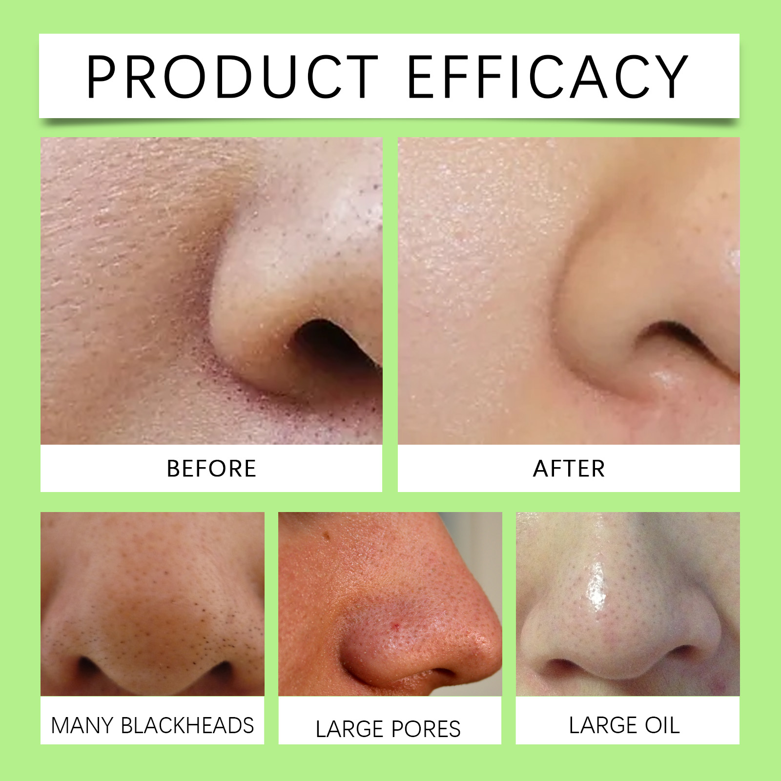 Bamboo Charcoal Nose Strips fo - đánh giá và giá Skincare China