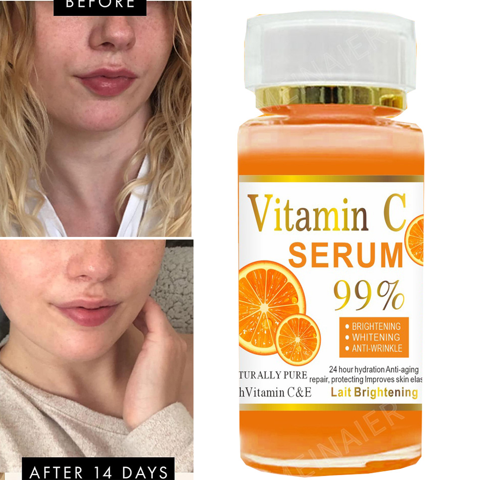 Super 120ml Vitamin C Serum An - đánh giá và giá Vitamin C Serum