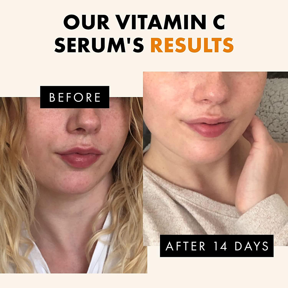 Super 120ml Vitamin C Serum An - đánh giá và giá Vitamin C Serum